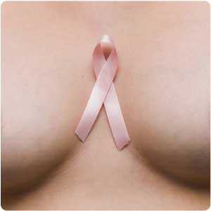 Tumori: seno, scoperto gene chiave