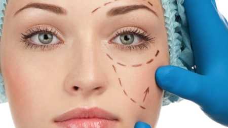 Bellezza, nuova tecnica made in Italy per ringiovanire il viso senza cicatrici ed effetto “tirato”