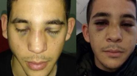 Pestaggio straniero all’Unical, identificati tre ragazzi Il giovane paraguayano stava difendendo uno studente. La condanna del mondo calabrese