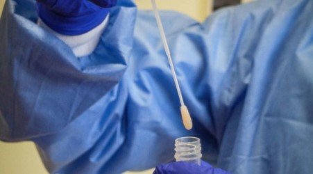 Coronavirus Asp Reggio Calabria, conferma di un nuovo positivo Il bollettino del Laboratorio del Polo Sanitario Ex-INAM di via Willermin