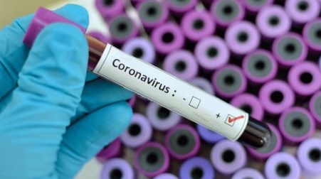 Coronavirus Calabria, nessun nuovo positivo Il bollettino della Regione Calabria